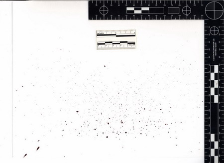 A drip bloodstain pattern.